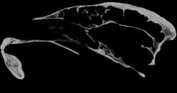 Crocuta sagittal slice 155