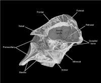 sagittal section