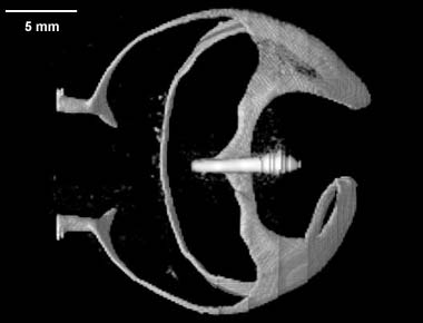 Terebratalia transversa