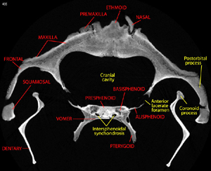 labeled coronal slice